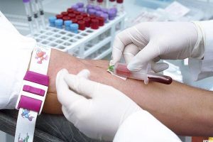 liquid biopsy